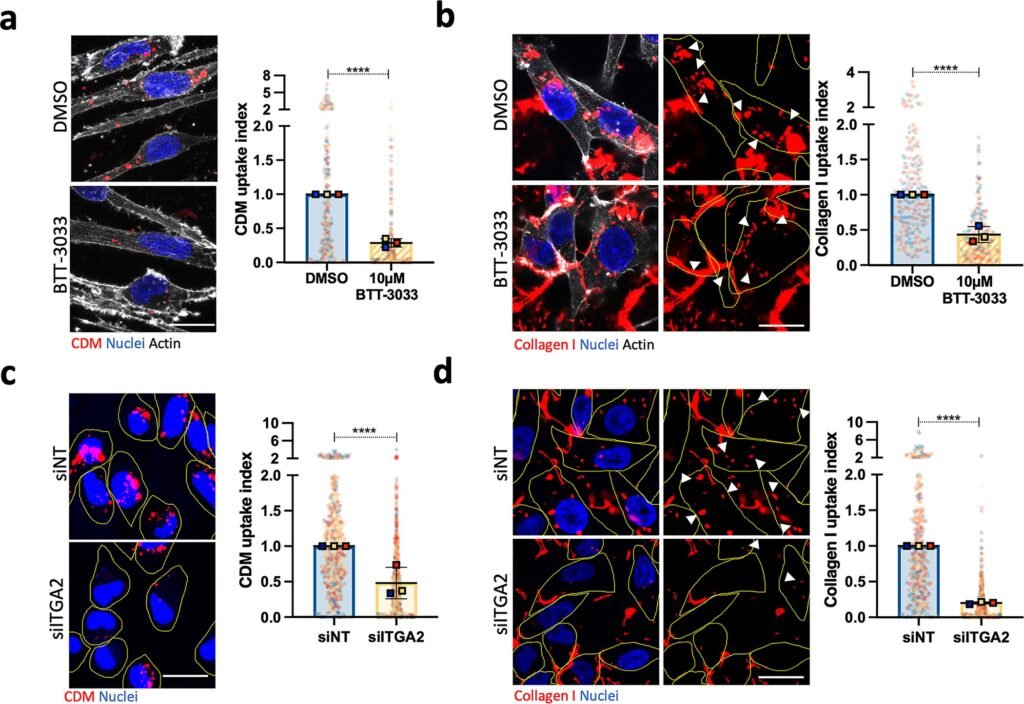 Cancer cells’ ‘eating’ ability could lead to new treatments