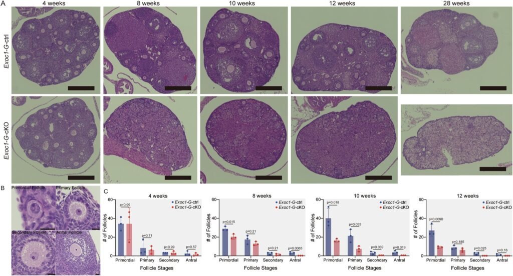 Exocyst complex failure in mice reveals a cause of female infertility