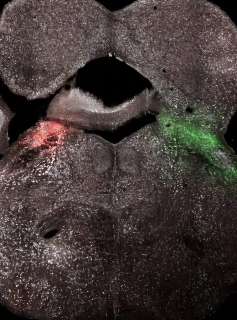 How specific brain regions drive chemotherapy-induced pain response
