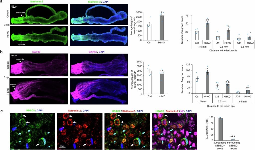 Discovery of HDAC8’s role in Schwann cell repair offers new insights into nerve regeneration