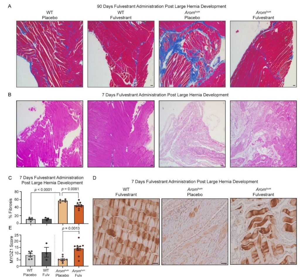 Drug reverses groin hernias in male mice without surgery, shows promise in humans