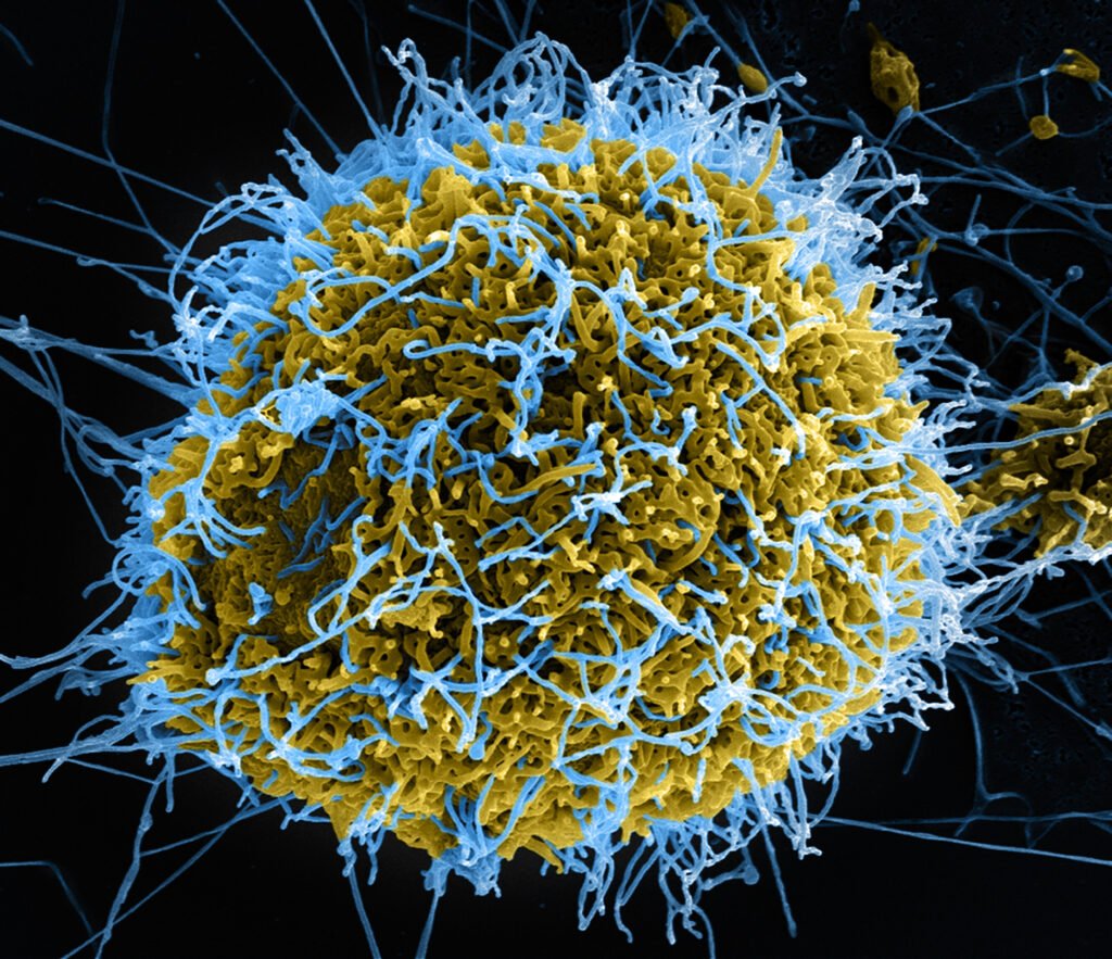 Lab-based study sheds light on the causes of fevers of unknown origin in sub-Saharan Africa