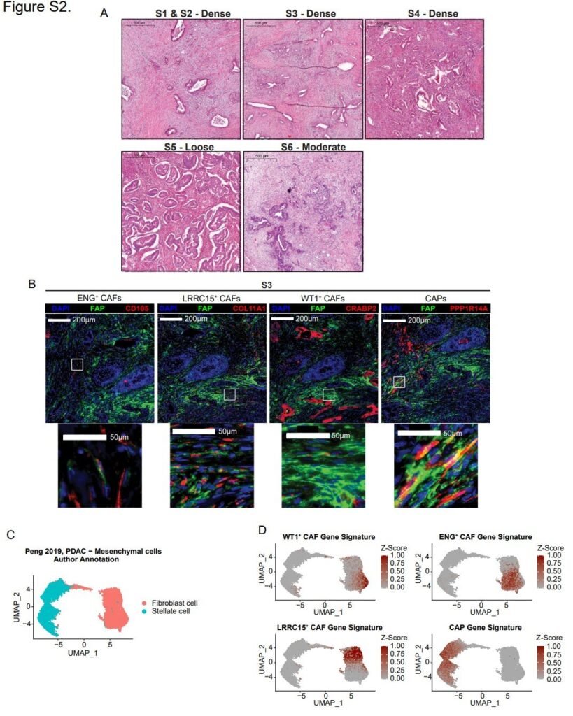 Newly discovered cells in connective tissue open up strategy against pancreatic cancer