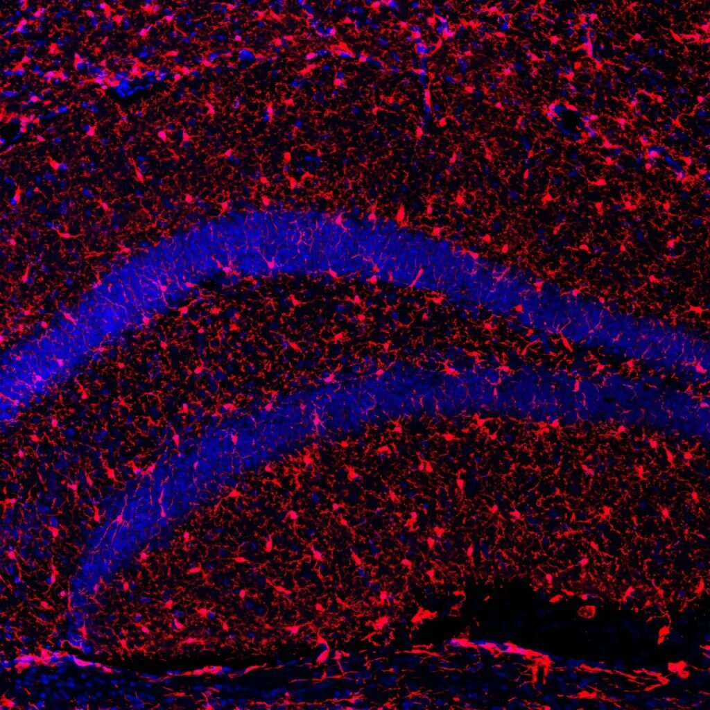 A protein that promotes healthy aging and improves longevity