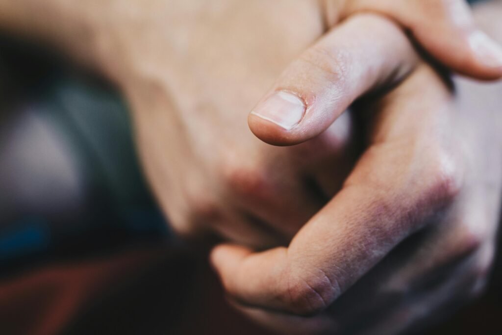 Patient with advanced skin cancer in remission for more than a year following clinical trial of WTX-124
