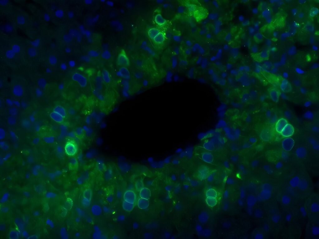 Signals from dying cells may spur liver regeneration after acetaminophen injury