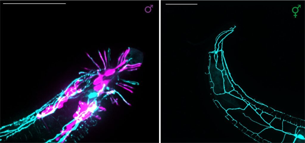 Structure of a single neuron in C. elegans provides new insights