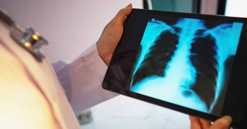 Viz.ai partners with Regeneron, Sanofi to study COPD tool