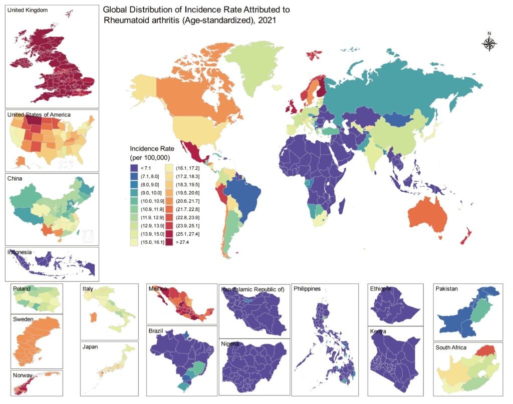 AI-powered study shows surge in global rheumatoid arthritis since 1980, revealing local hotspots