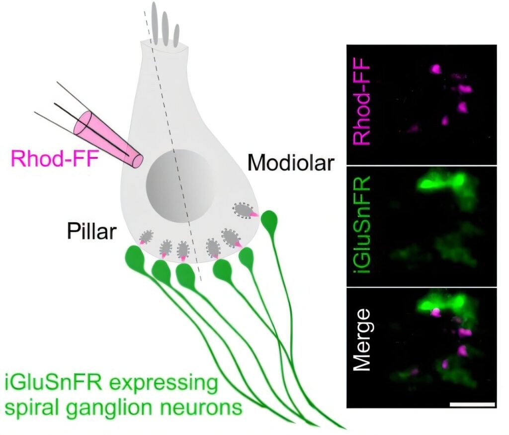 How dysfunction of a cellular calcium channel affects hearing