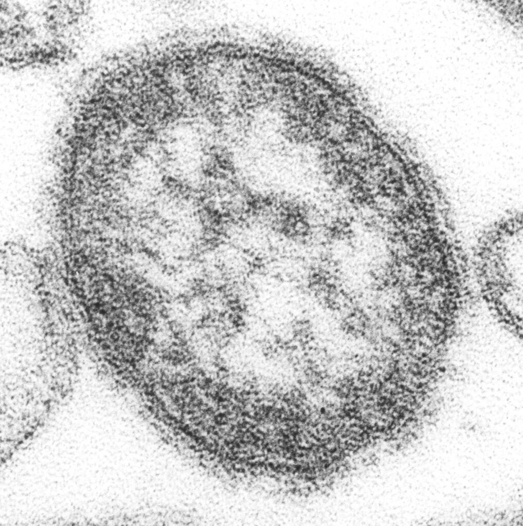 Many forget the damage done by diseases like whooping cough, measles and rubella. Not these families