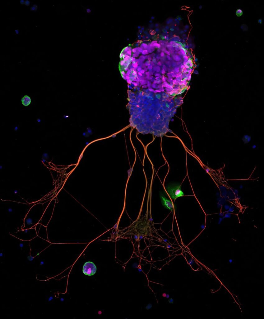 Stem cells thought to be dormant may offer clues to why sense of smell is lost or declines