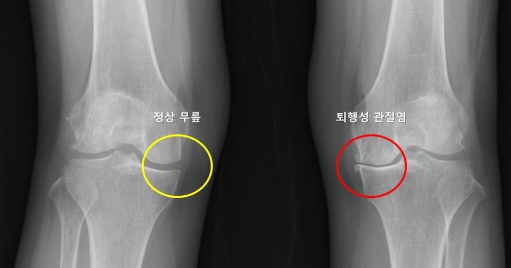 Korean AI can predict contralateral knee osteoarthritis and more Korea briefs