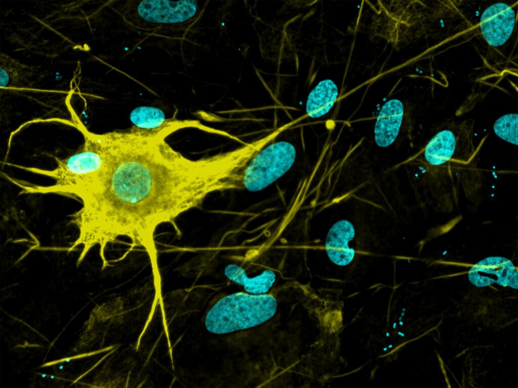 Looking to study neurological conditions, researchers produce over 400 different types of nerve cells