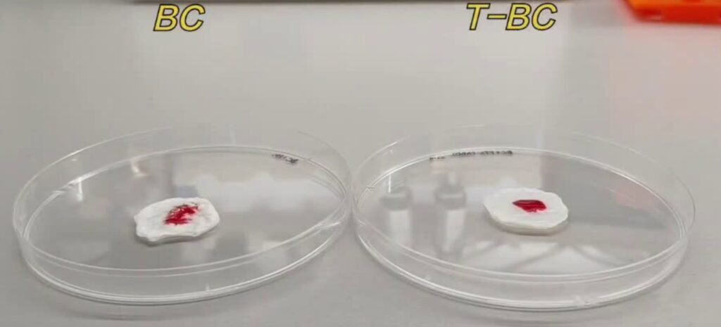 Bacterial cellulose-based dressing offers rapid bleeding control for burn wound care