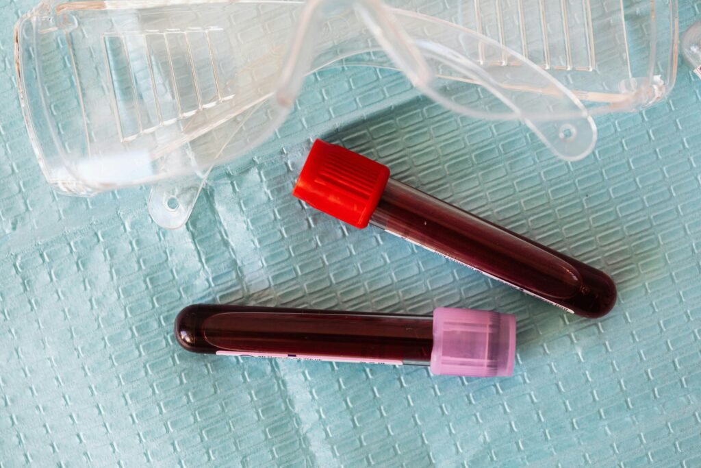 Prediabetes more life-threatening for people aged 20–54, study finds