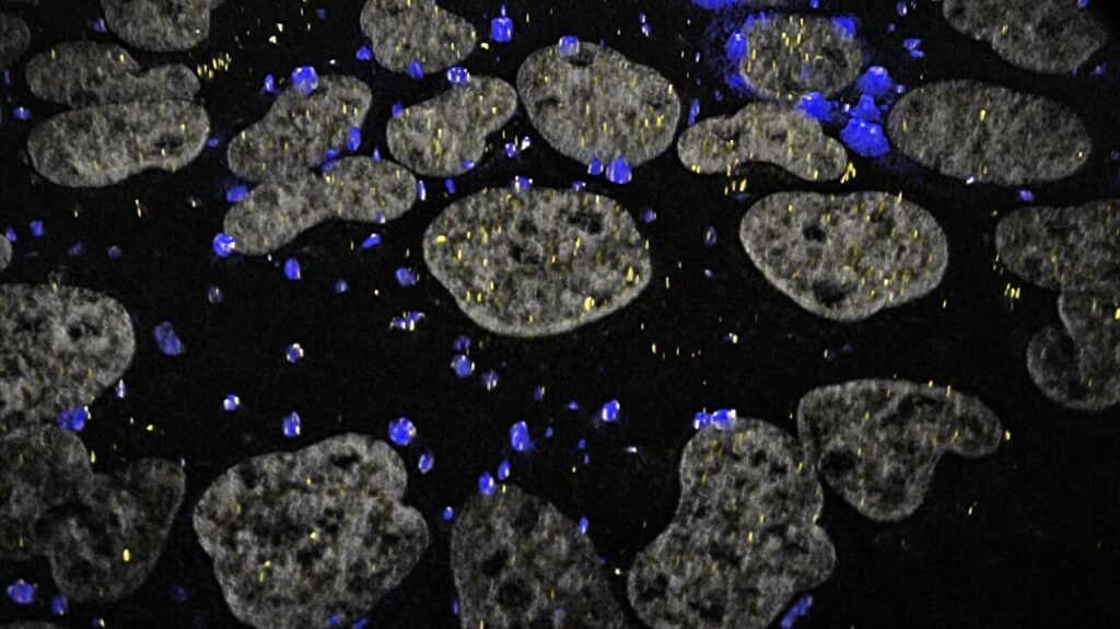 Researchers determine how cells prevent RNA traffic jams under stress