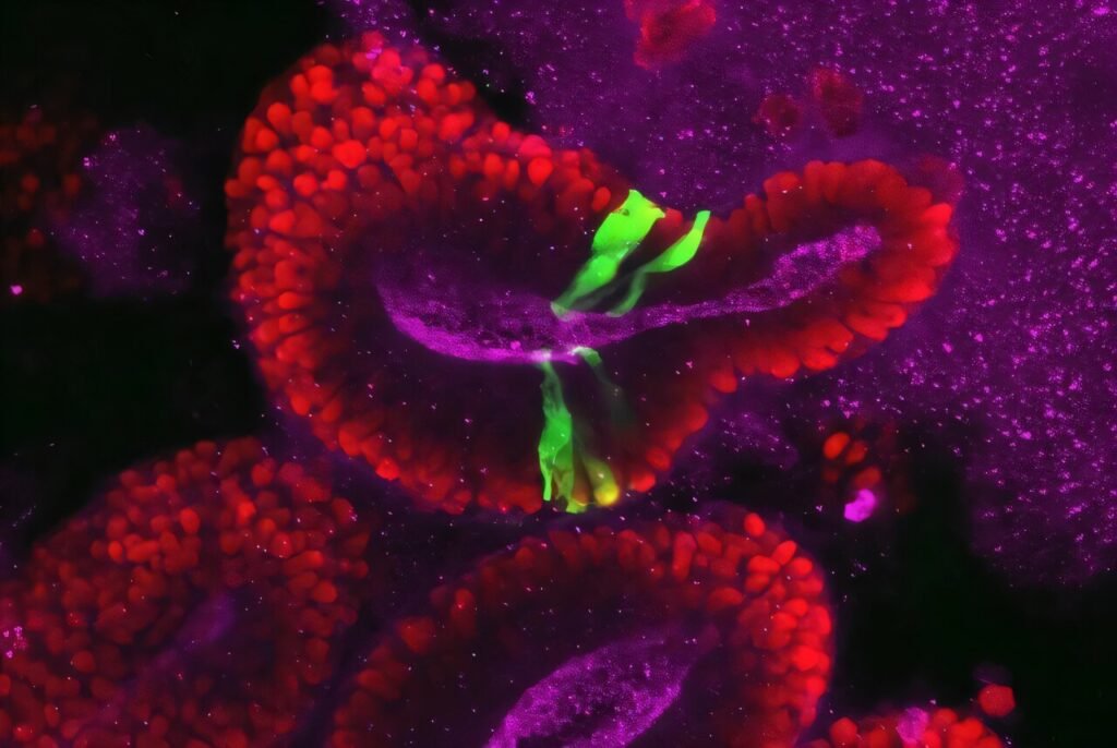 Study links reduced ribosome levels to vulnerability in developing brain cells