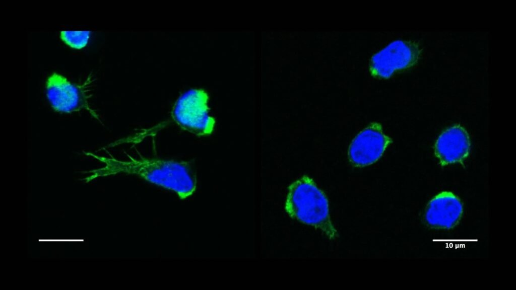 How cell skeleton defects can teach immunology