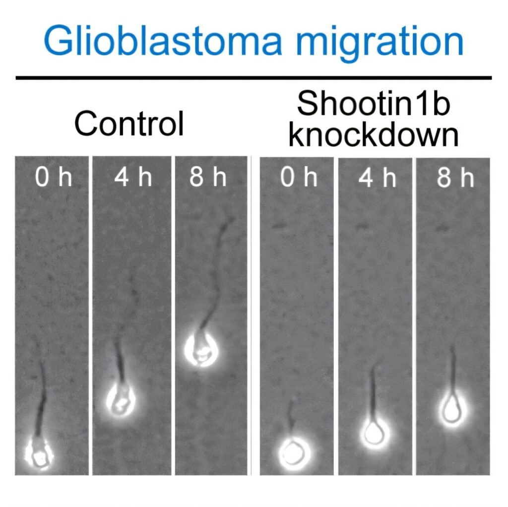 Identifying the interactions that drive cell migration in brain cancer