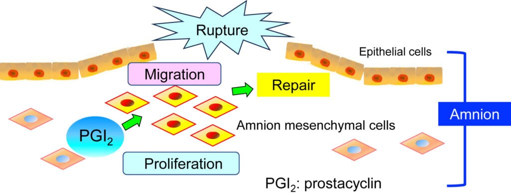 Study uncovers crucial role of prostacyclin in fetal membrane healing