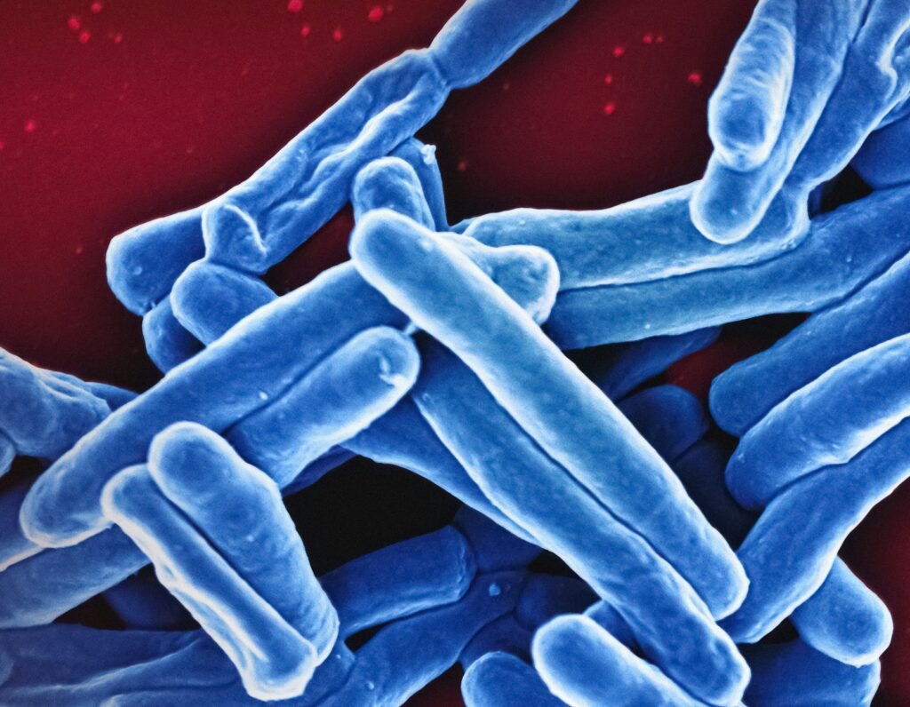 What to know about tuberculosis as it surfaces in Maine and North Carolina. Who is at risk?