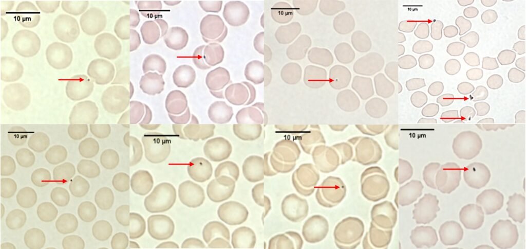 Air pollution particles discovered hitching a ride around the body on red blood cells