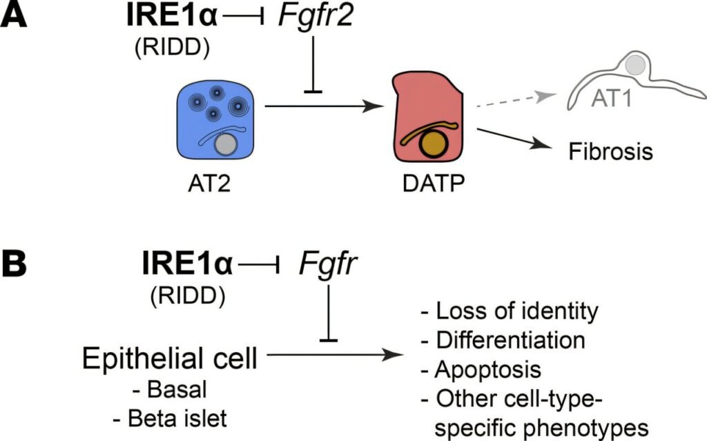 Blocking a key protein halts lung scarring in mouse model of fibrosis