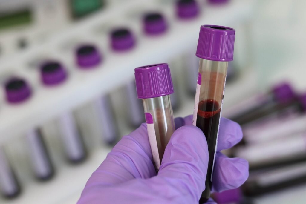 Clinical practice recommendations for haematopoietic cell transplantation and CAR-T therapy, new for 2025