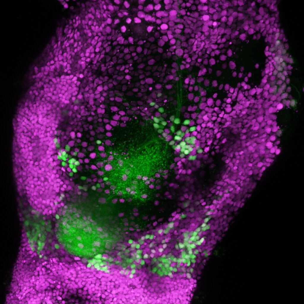 Fruity fly study uncovers neural circuits for sensing the pleasantness or unpleasantness of odors