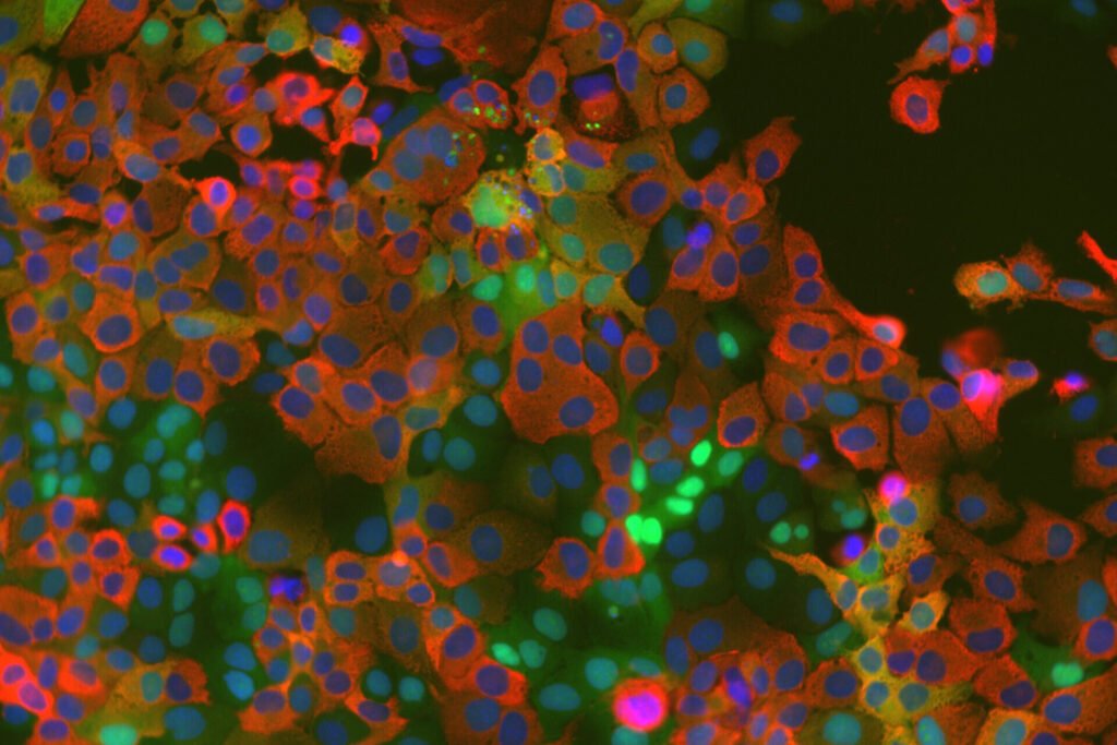 Coronavirus replication relies on newly identified host enzyme, study finds